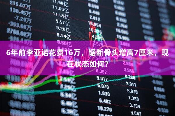 6年前李亚诺花费16万，锯断骨头增高7厘米，现在状态如何？